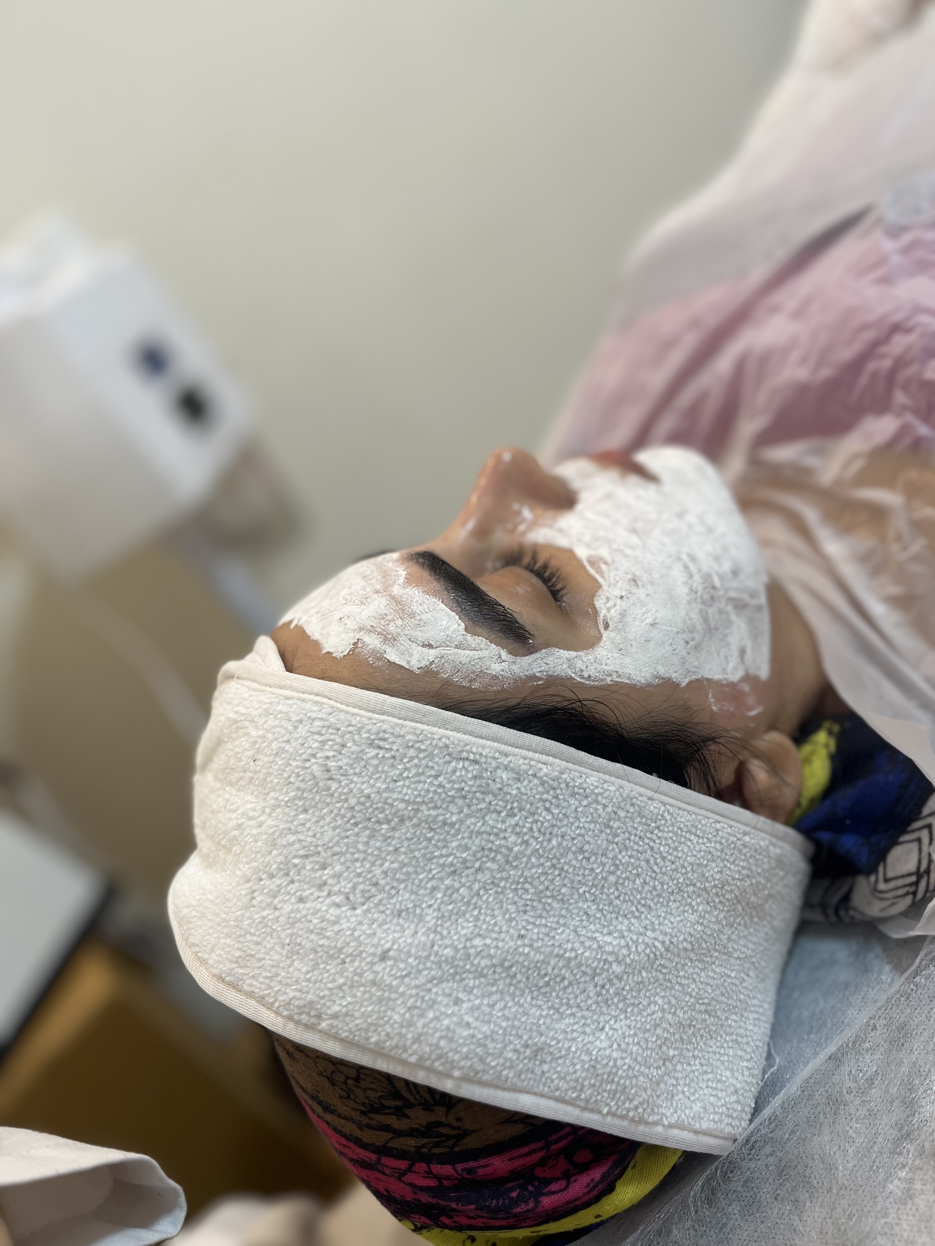 لیزر موهایی زائد بیوتینا