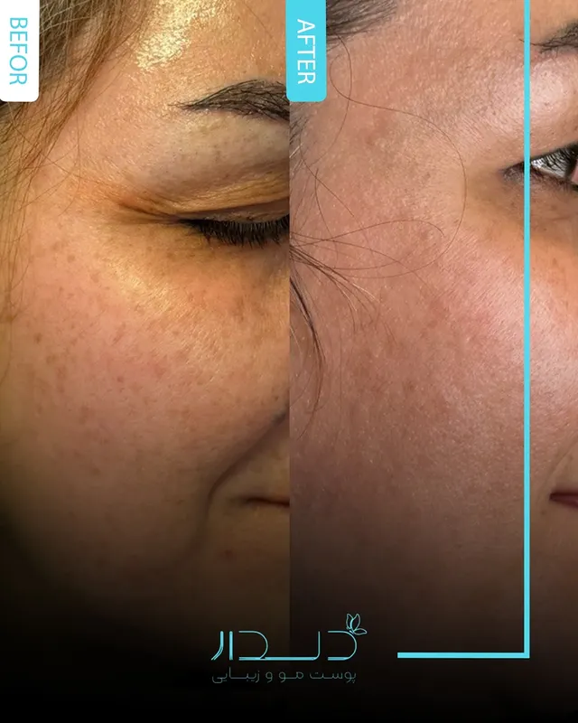 مرکز پوست و لیزر سایناشور آمریکا دلدار