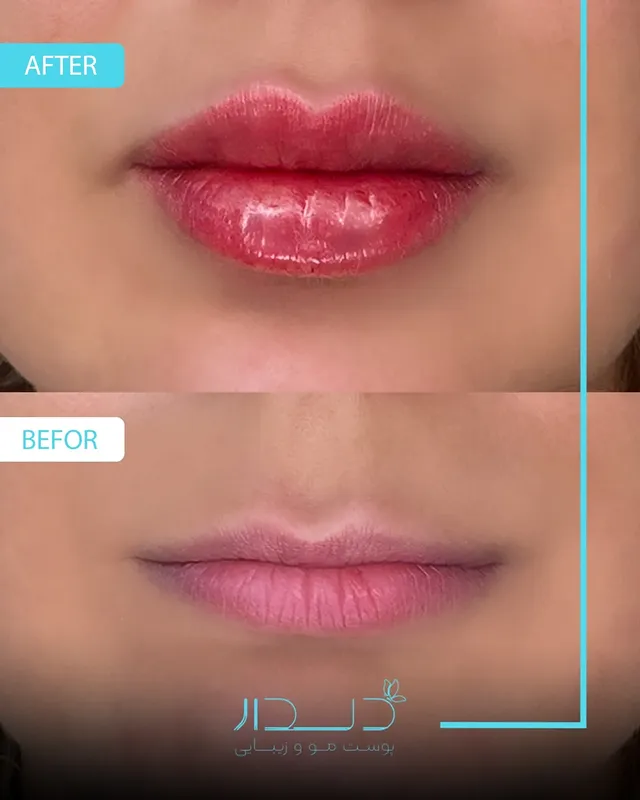 تصویر گالری