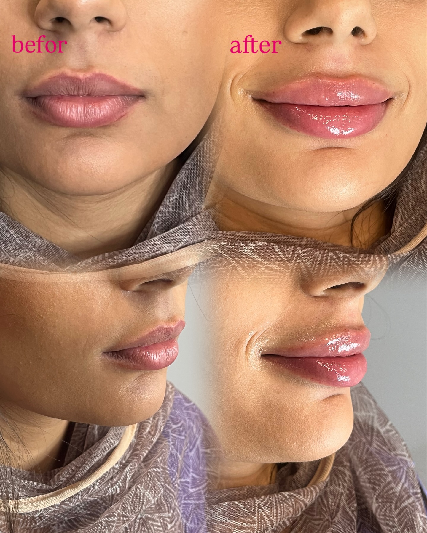 مرکز لیزر و کلینیک زیبایی پریفا