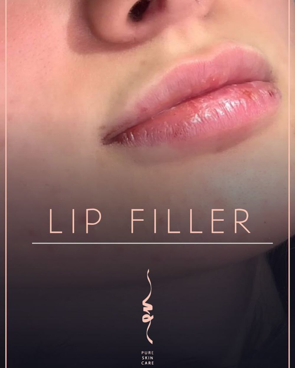 مرکز تخصصی لیزر و زیبایی و لاغری پیور