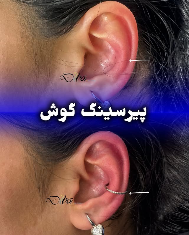 تصویر گالری