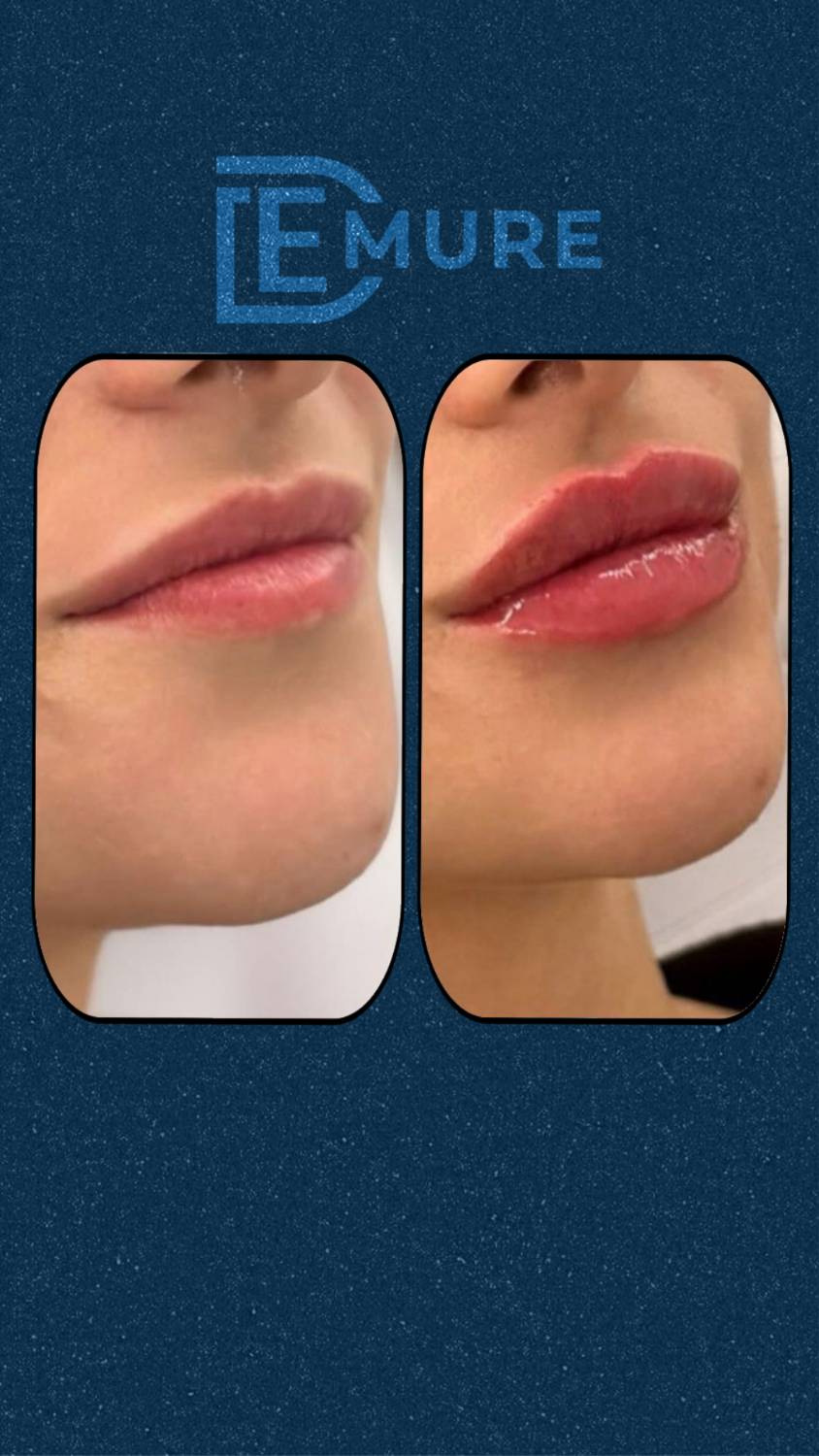 مرکز لیزر و زیبایی دمور