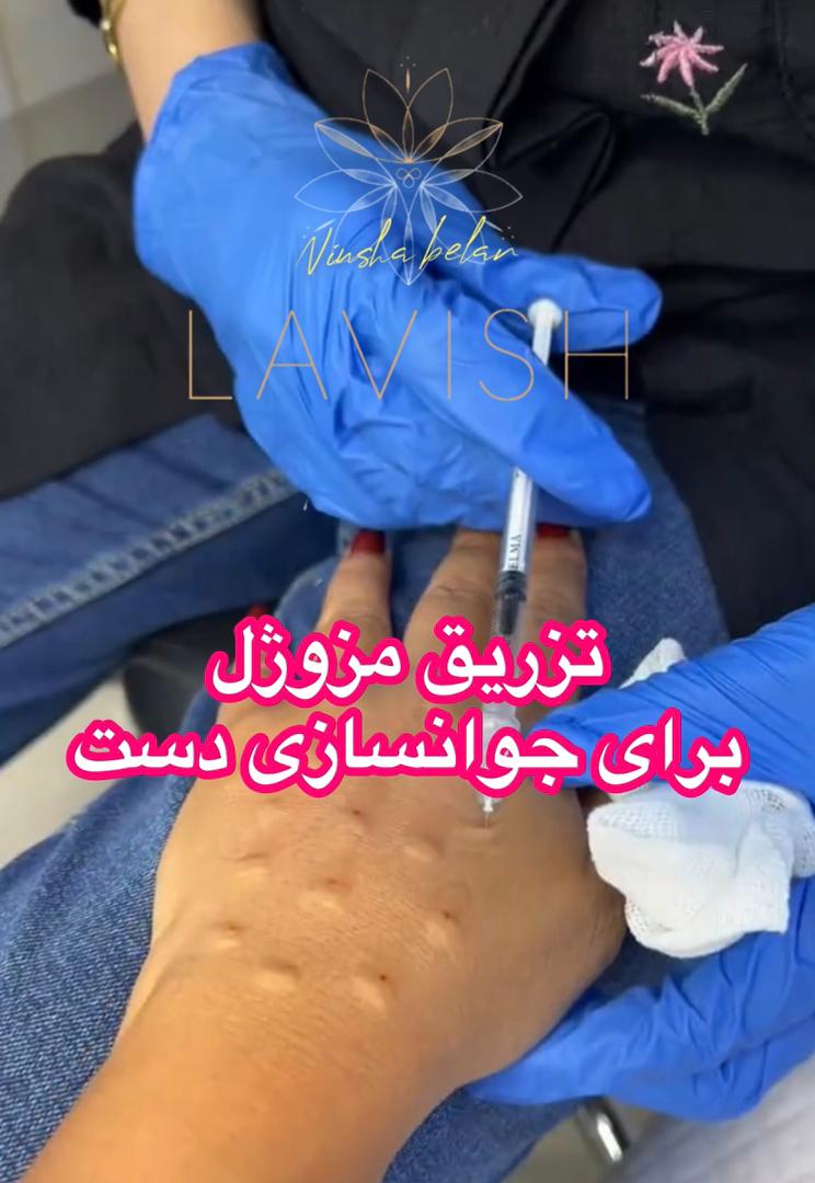 تصویر گالری