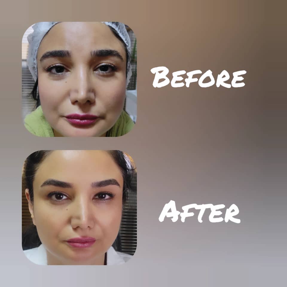 كلينيک پوست ،مو و زیبایی بيوتا