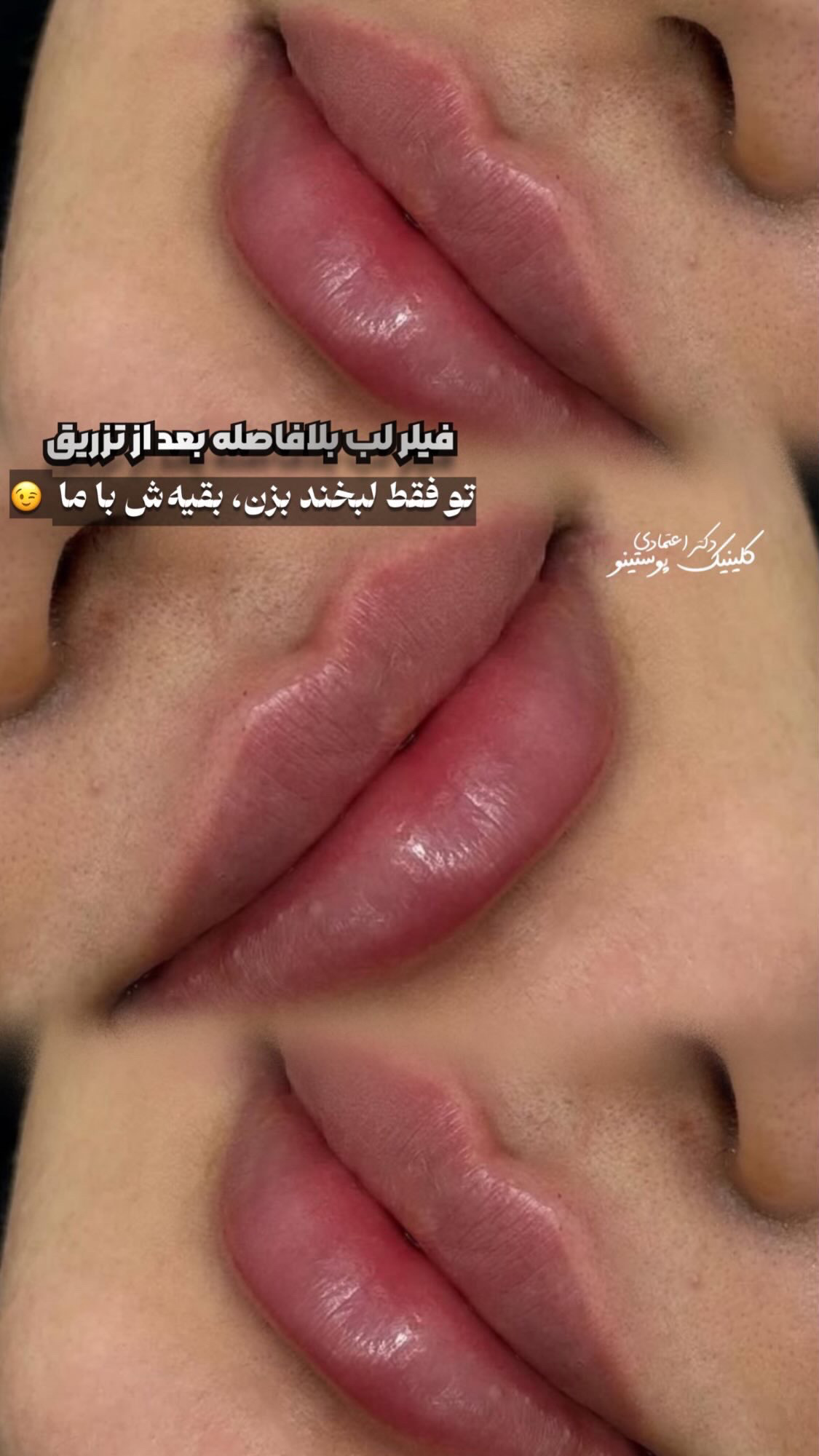 کلینیک زیبایی پوستینو