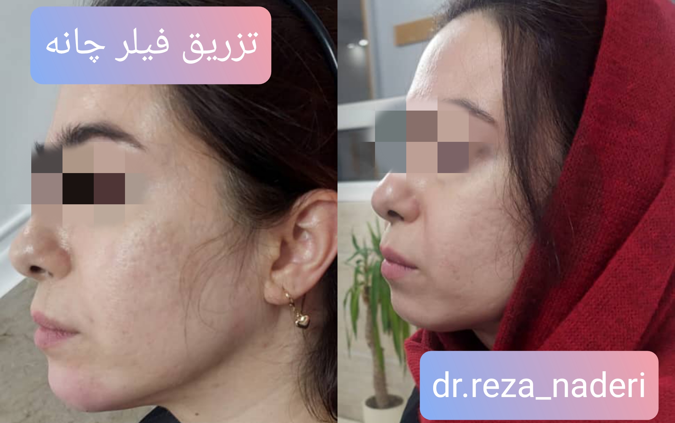 مرکز زیبایی و لیزر دکتر رضا نادری